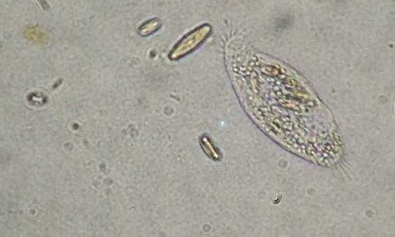 infusoire (paramécie)