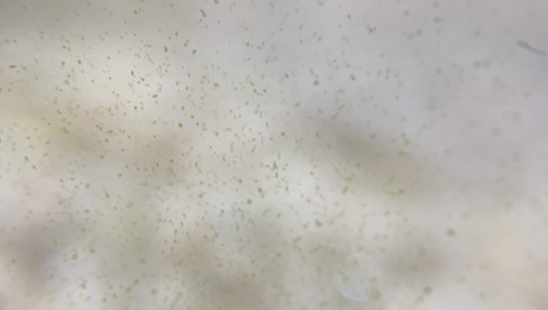 J+7 Apparition d’algues