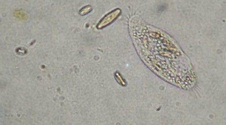 infusoire (paramécie)