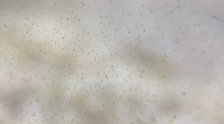 J+7 Apparition d’algues