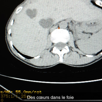 aquariophile Ikkitokken